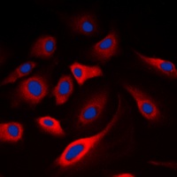 Calmodulin (Phospho-T80/S82) Rabbit Polyclonal Antibody