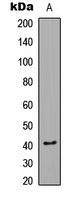 CaMK1 alpha (Phospho-T177) Rabbit Polyclonal Antibody