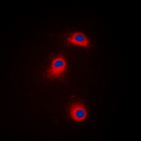 CaMK1 alpha (Phospho-T177) Rabbit Polyclonal Antibody