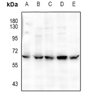 CaMK2 alpha/delta (Phospho-T286) Rabbit Polyclonal Antibody