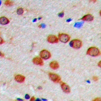 CaMK2 alpha/delta (Phospho-T286) Rabbit Polyclonal Antibody