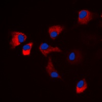 CaMK2 alpha/delta (Phospho-T286) Rabbit Polyclonal Antibody