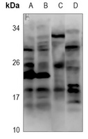 CCL11 Rabbit Polyclonal Antibody