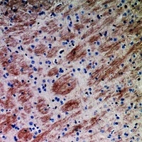 CCL26 Rabbit Polyclonal Antibody