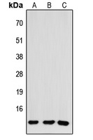 CCL26 Rabbit Polyclonal Antibody