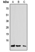 CCL7 Rabbit Polyclonal Antibody