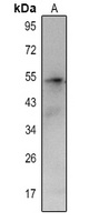 CCR4 Rabbit Polyclonal Antibody
