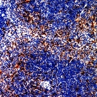 CCR4 Rabbit Polyclonal Antibody