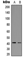 CCR5 (Phospho-S336) Rabbit Polyclonal Antibody