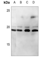 CD247 Rabbit Polyclonal Antibody
