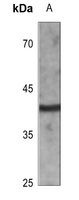 CD72 Rabbit Polyclonal Antibody
