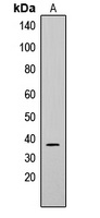 CD79b Rabbit Polyclonal Antibody