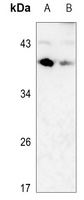 CD79b Rabbit Polyclonal Antibody