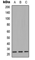 CD9 Rabbit Polyclonal Antibody