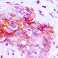 CD9 Rabbit Polyclonal Antibody
