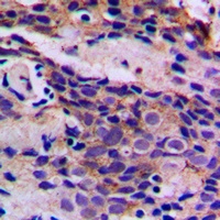 CDK5 (Phospho-Y15) Rabbit Polyclonal Antibody