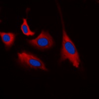 CDK5 (Phospho-Y15) Rabbit Polyclonal Antibody