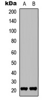 p21 (Phospho-T145) Rabbit Polyclonal Antibody