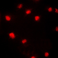 p21 (Phospho-T145) Rabbit Polyclonal Antibody