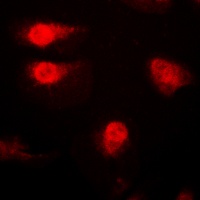 p27 Kip1 (Phospho-T187) Rabbit Polyclonal Antibody