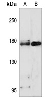 CD66e Rabbit Polyclonal Antibody