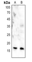CENPA Rabbit Polyclonal Antibody