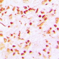 CENPA Rabbit Polyclonal Antibody