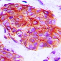 Claudin 6 Rabbit Polyclonal Antibody