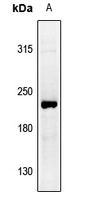 Collagen 2 alpha 1 Rabbit Polyclonal Antibody