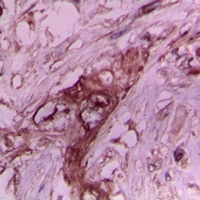 Collagen 2 alpha 1 Rabbit Polyclonal Antibody