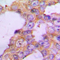 COX5B Rabbit Polyclonal Antibody