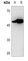 CD116 Rabbit Polyclonal Antibody