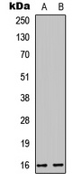 Cystatin E/M Rabbit Polyclonal Antibody