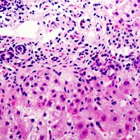 Cystatin E/M Rabbit Polyclonal Antibody