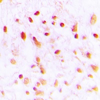 CTBP1 Rabbit Polyclonal Antibody