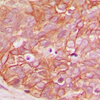 Beta-catenin (Phospho-S33) Rabbit Polyclonal Antibody