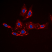 Beta-catenin (Phospho-S33) Rabbit Polyclonal Antibody