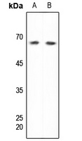 DDX5 Rabbit Polyclonal Antibody