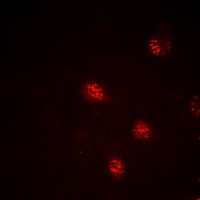 DDX5 Rabbit Polyclonal Antibody
