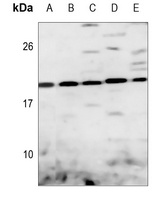 DUSP22 Rabbit Polyclonal Antibody