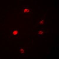 DUSP22 Rabbit Polyclonal Antibody