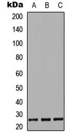 IL-27B Rabbit Polyclonal Antibody