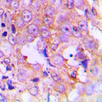 EEF2 (Phospho-T56) Rabbit Polyclonal Antibody