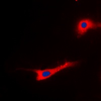 EEF2 (Phospho-T56) Rabbit Polyclonal Antibody