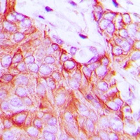 Ephrin A5 Rabbit Polyclonal Antibody