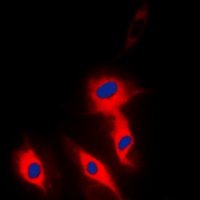 Ephrin A5 Rabbit Polyclonal Antibody