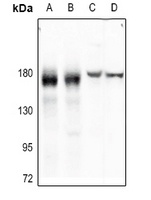 EGFR Rabbit Polyclonal Antibody