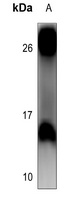 4EBP1 Rabbit Polyclonal Antibody