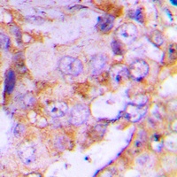 4EBP1 Rabbit Polyclonal Antibody