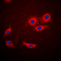 4EBP1 Rabbit Polyclonal Antibody
